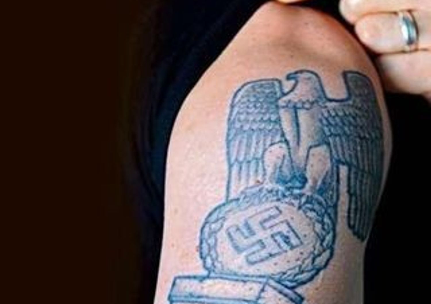 GERMANIA: HA UN TATUAGGIO NAZISTA, CHIRURGO EBREO NON LO OPERA