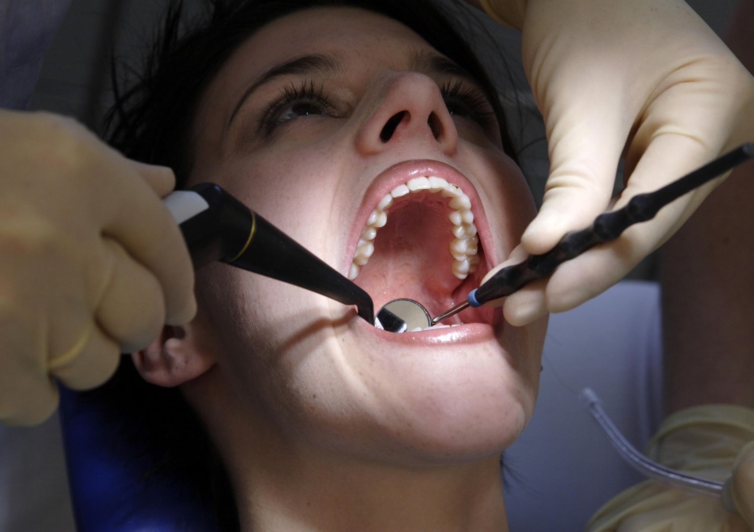 Dentista, dentisti, studi odontoiatrici, denti, cure dentistiche (Agf)