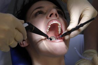 Dentista, dentisti, studi odontoiatrici, denti, cure dentistiche (Agf)
