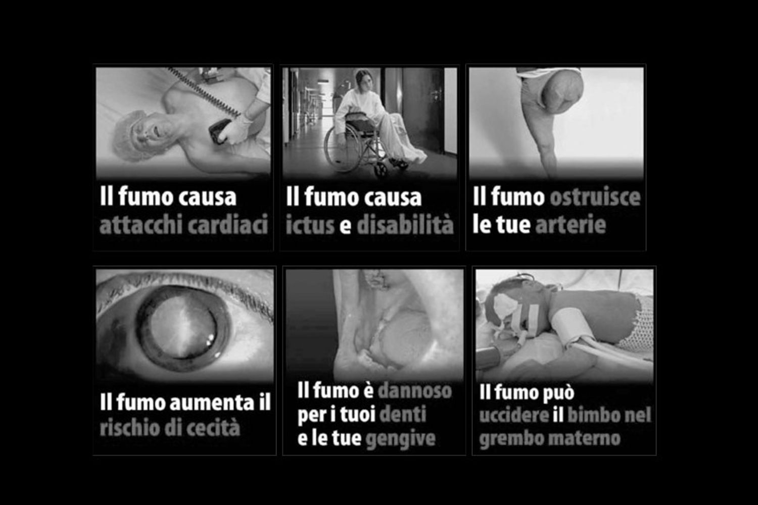 &nbsp; Immagini choc sui pacchetti di sigarette