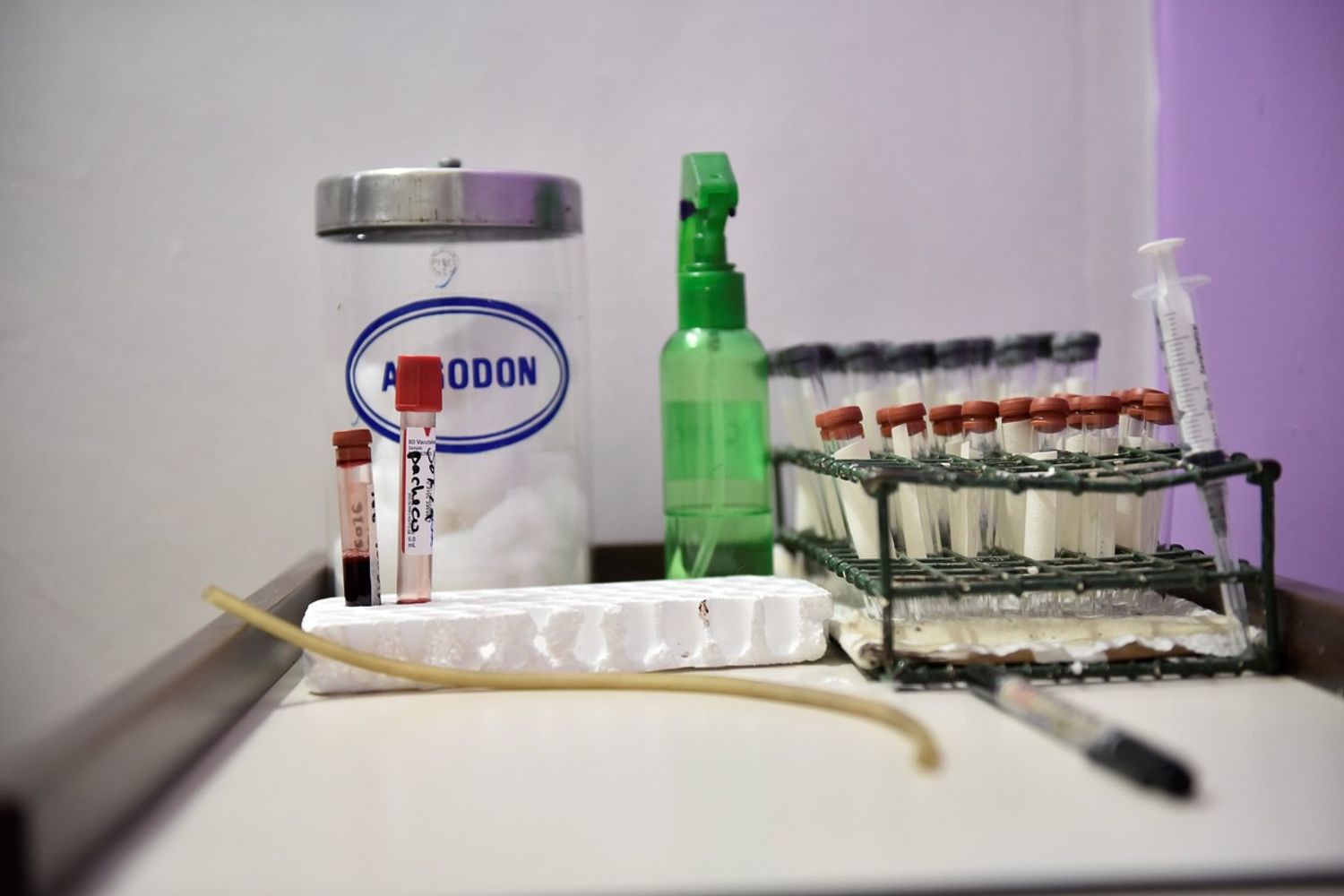 &nbsp;Zika, laboratorio, vaccino, cure, sperimentazione