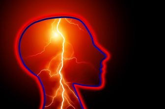 &nbsp;ictus epilessia mal di testa emicrania - pixabay