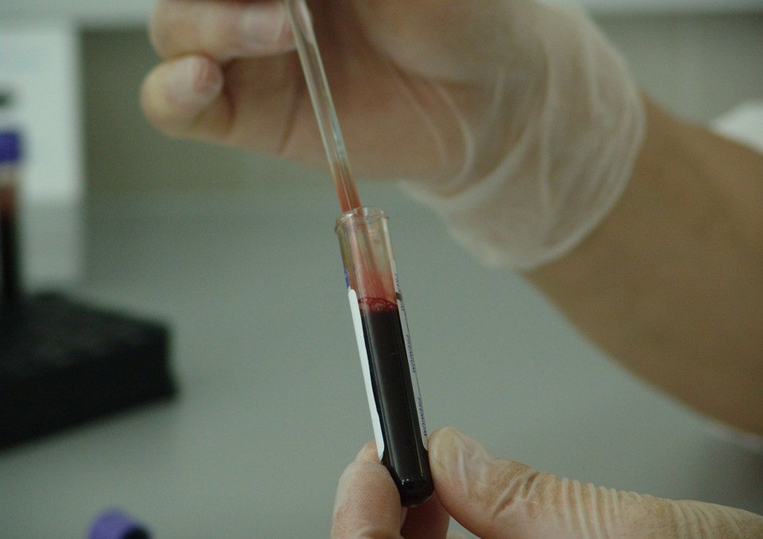 &nbsp; ricerca ricercatori sangue provette analisi campione medicina - pixabay