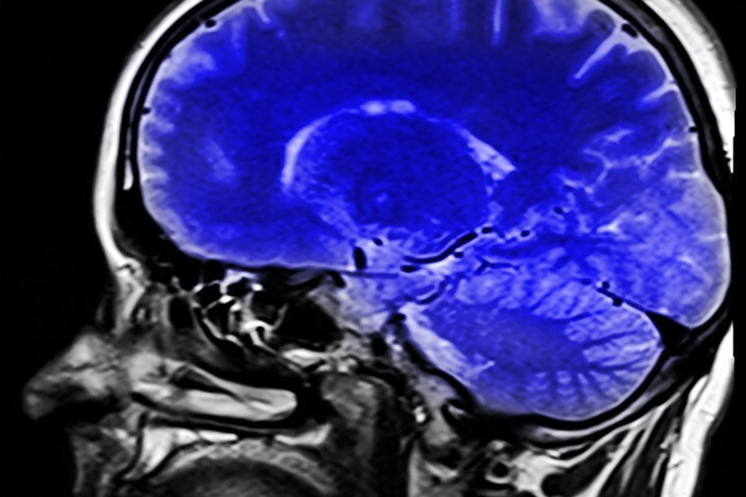 cervello testa cranio risonanza magnetica - pixabay