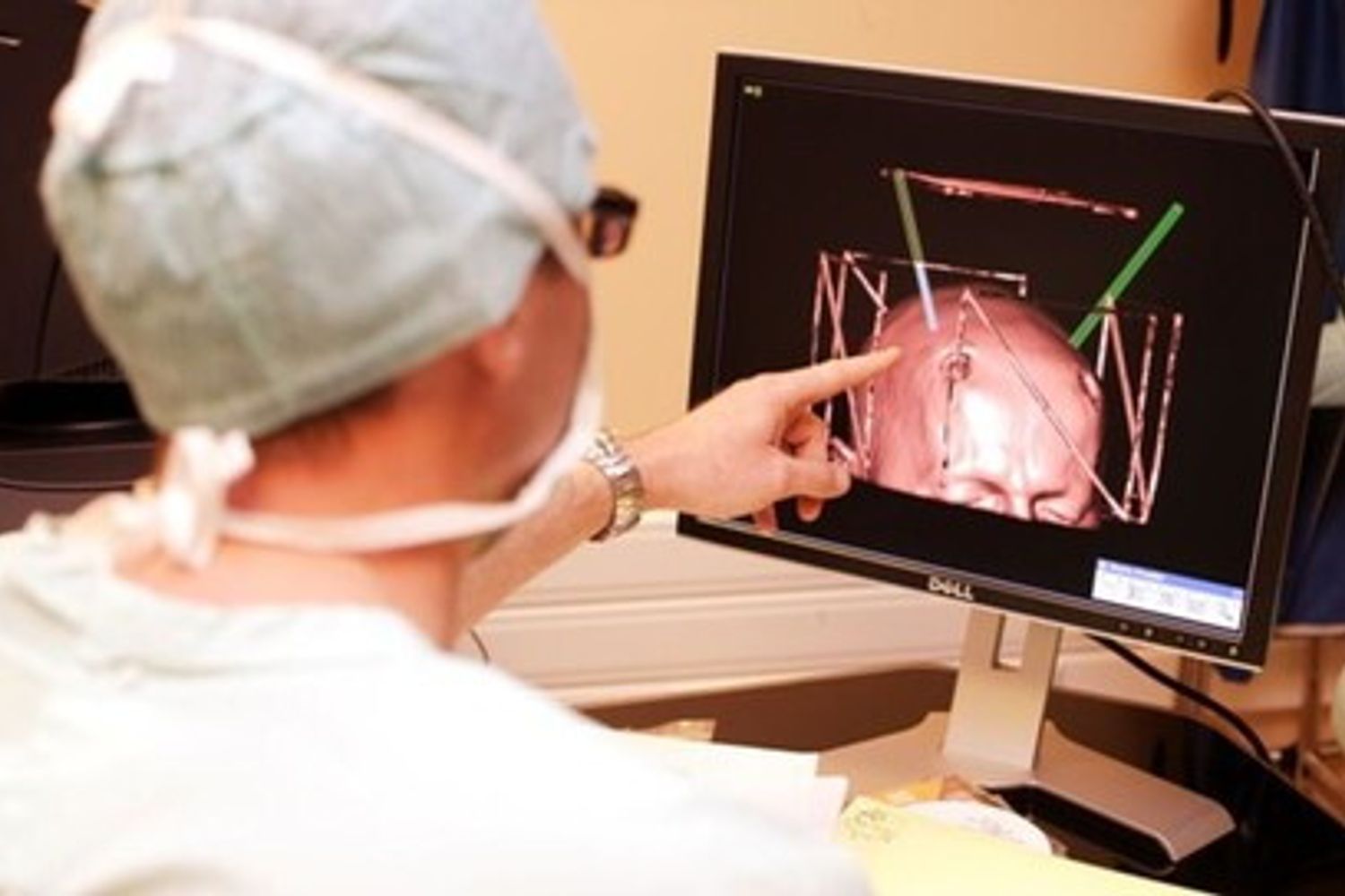 Cervello studio neurologia