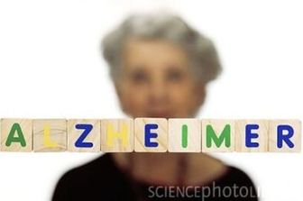 Alzheimer