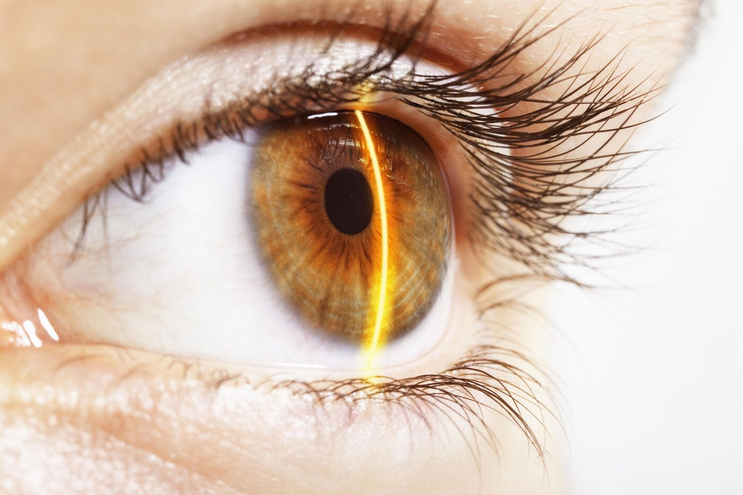 &nbsp; Occhio, laser, occhi, vista