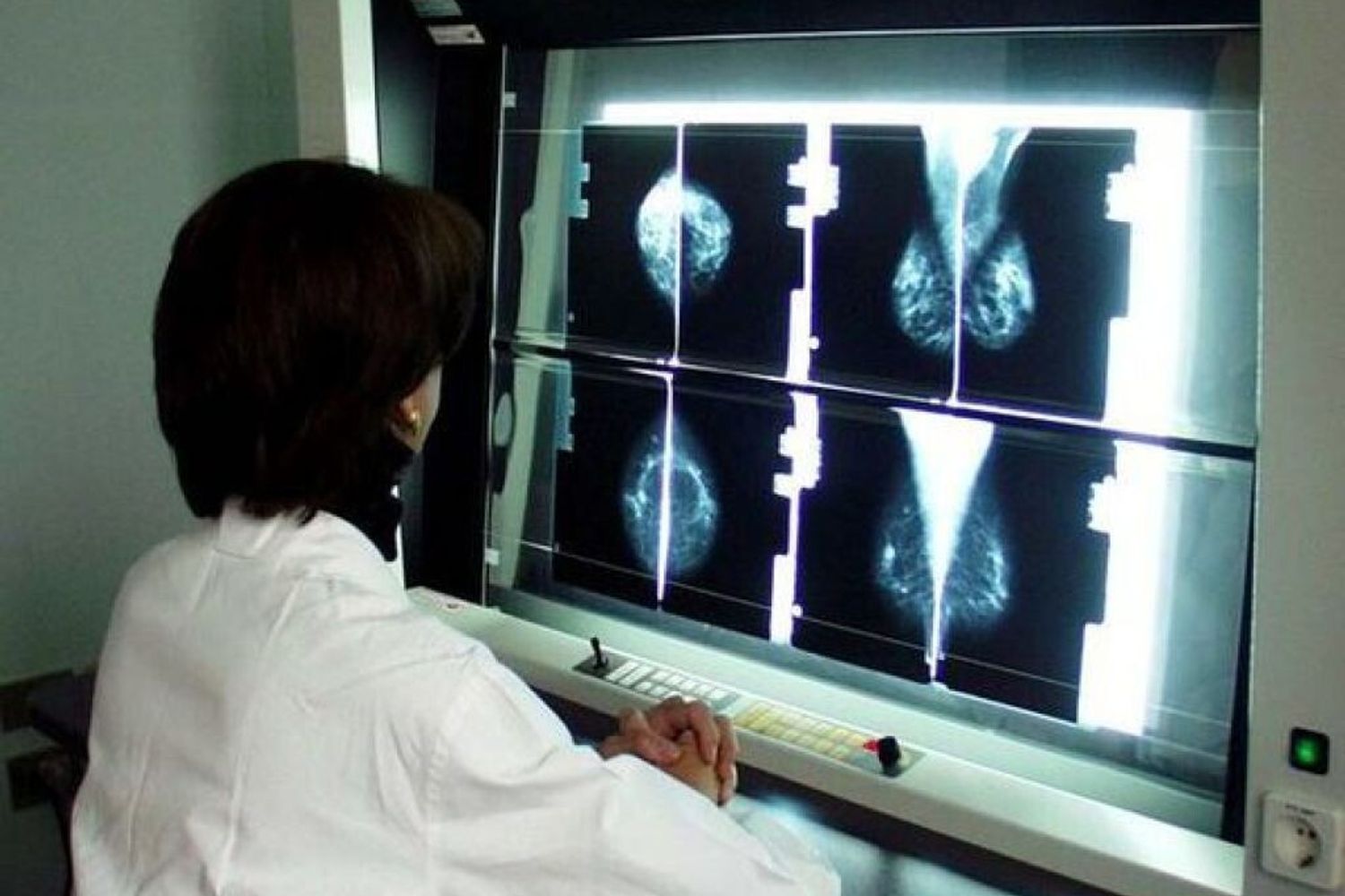 &nbsp;tumore cancro al seno lastre radiografie