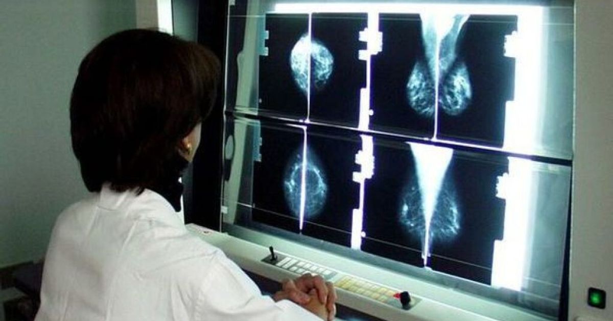 Un anticorpo blocca il cancro al seno triplo negativo