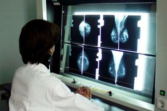 tumore cancro al seno lastre radiografie