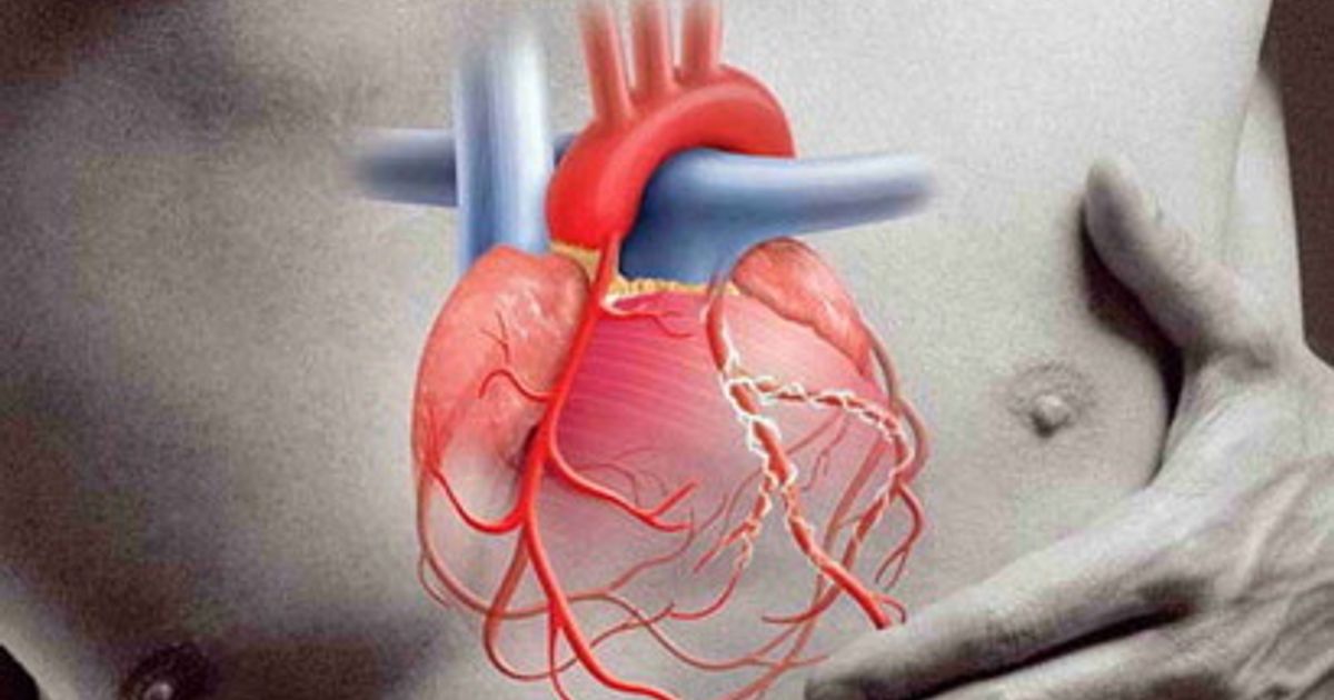 Ictus o infarto, al Gemelli si può scoprire quanto è alto il rischio