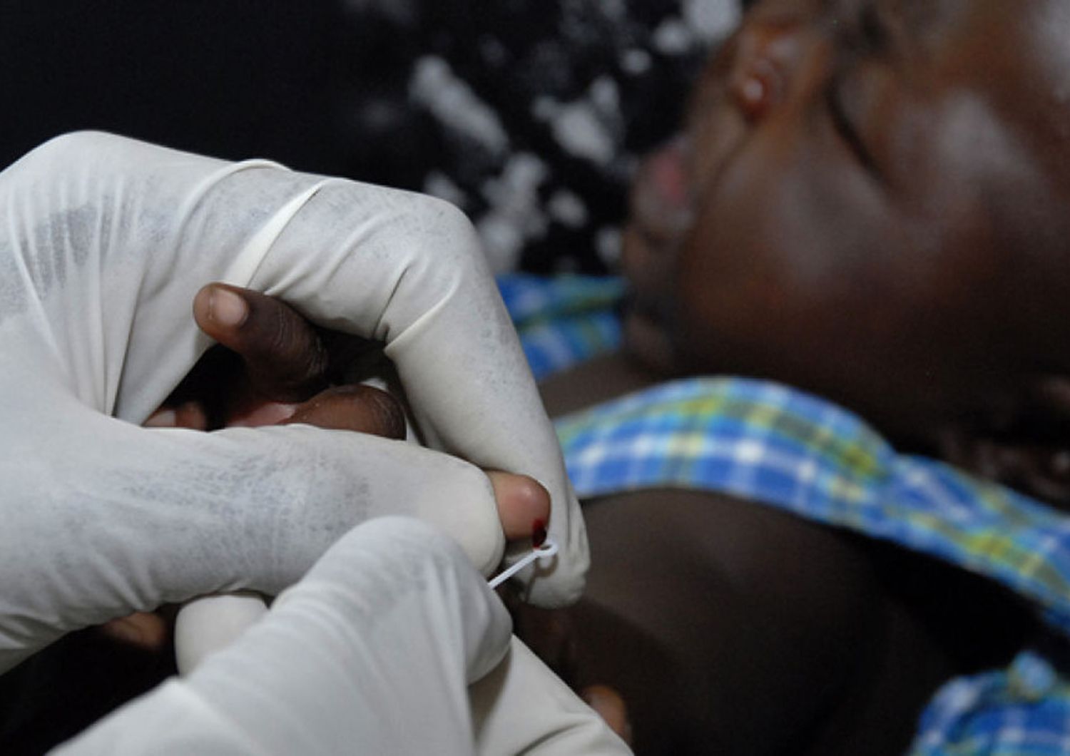 &nbsp;Malaria vaccino