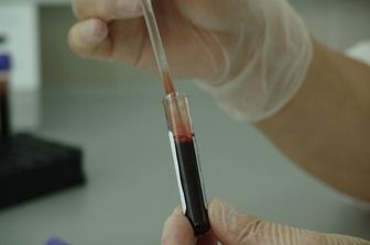 Analisi sangue esami test laboratorio genetica fertilità  - pixabay