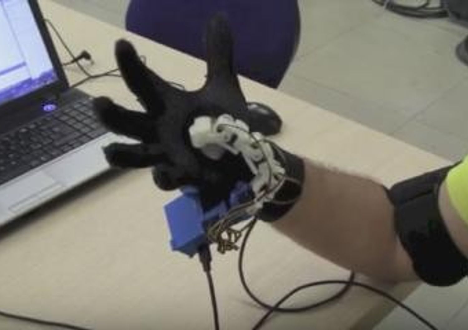 A Siena sesto dito robotico per migliore funzionalit&agrave; mani
