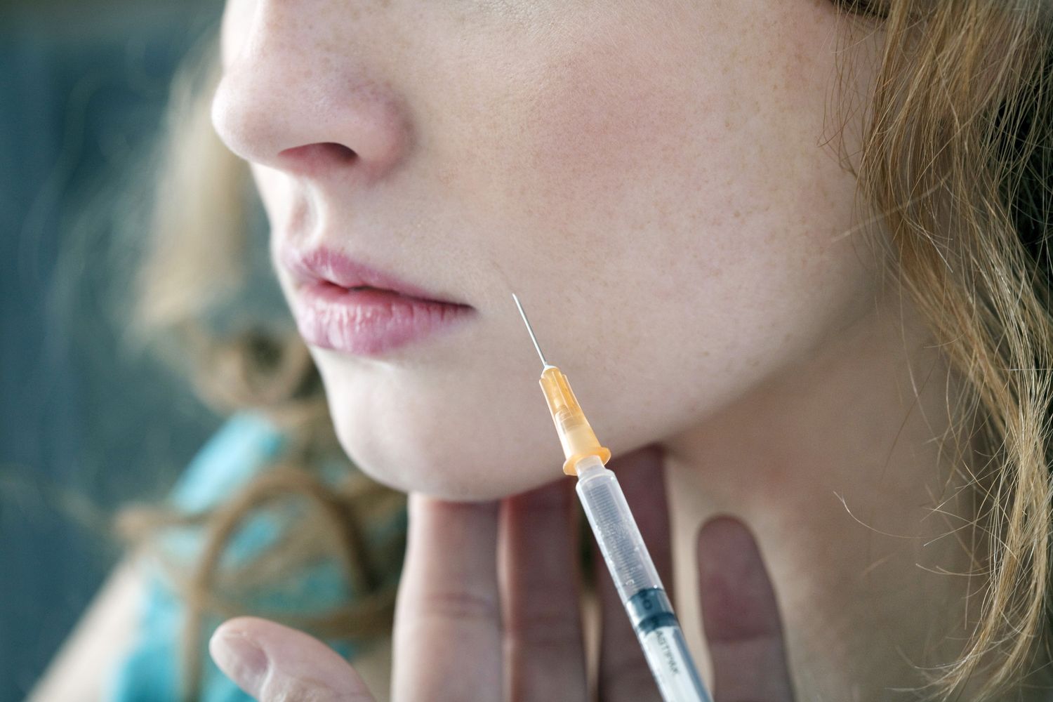 &nbsp;Botox botulino