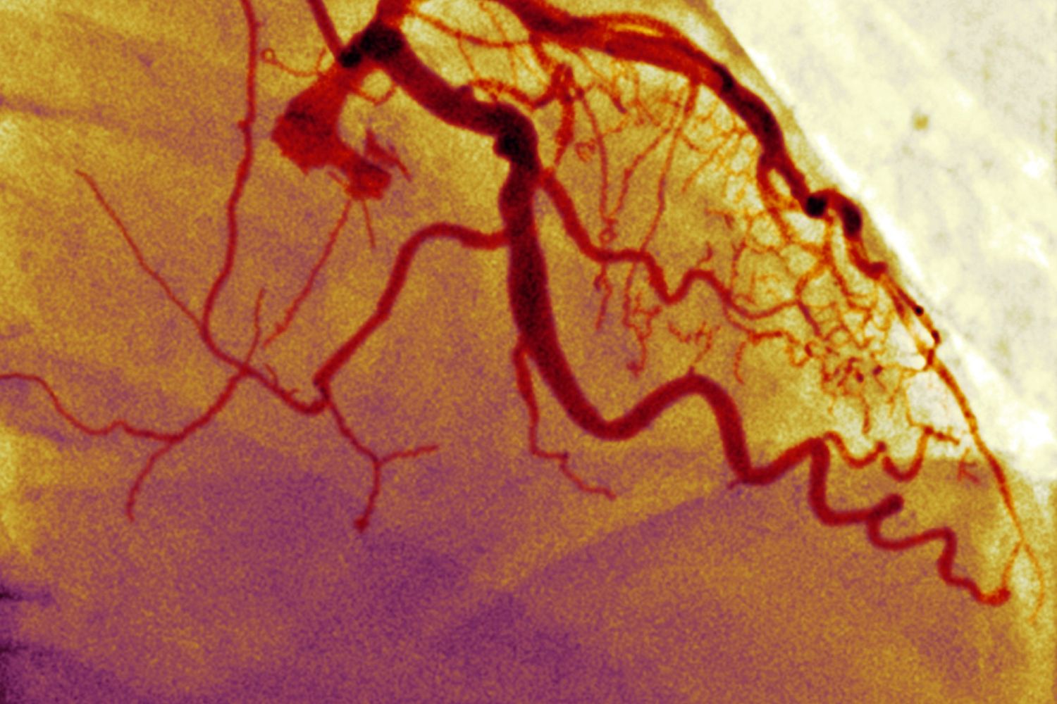 vasi sanguigni (afp)&nbsp;