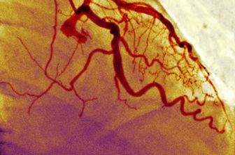 vasi sanguigni (afp)&nbsp;