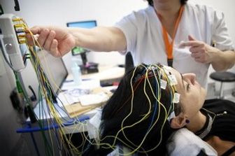 &nbsp;Epilessia neurologia esami clinici neurologici - afp