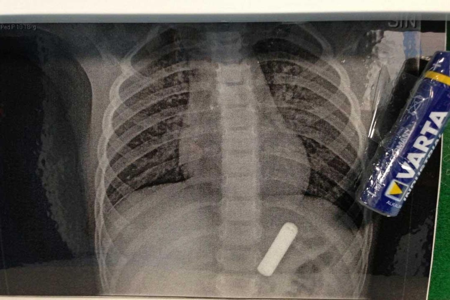 &nbsp; Workshop dall'Olglio, cosa mangiano i bambini