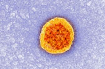 virus Epatite C (Afp)