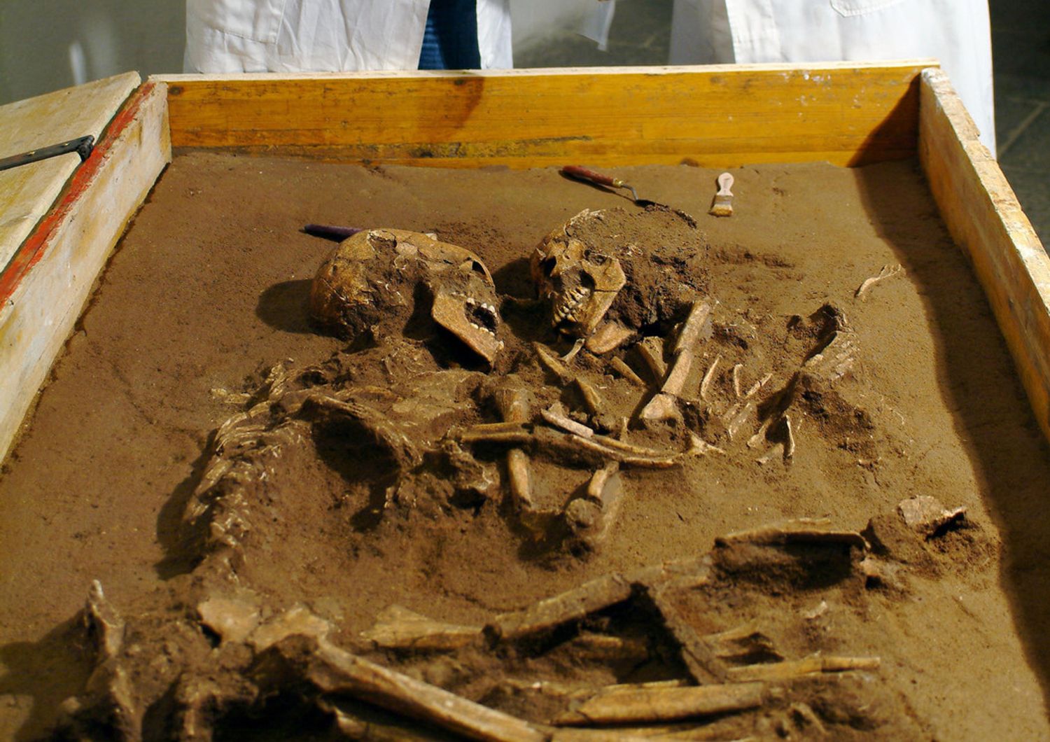 &nbsp; resti di ossa umane