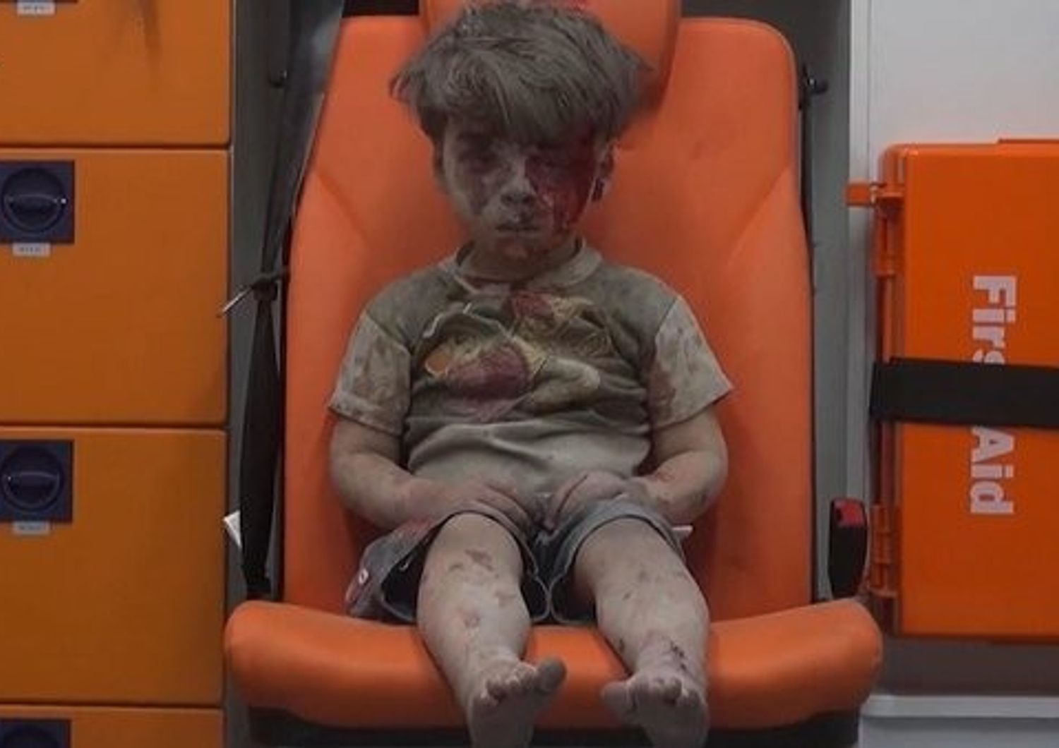 Omran Daqneesh (foto da twitter)&nbsp;