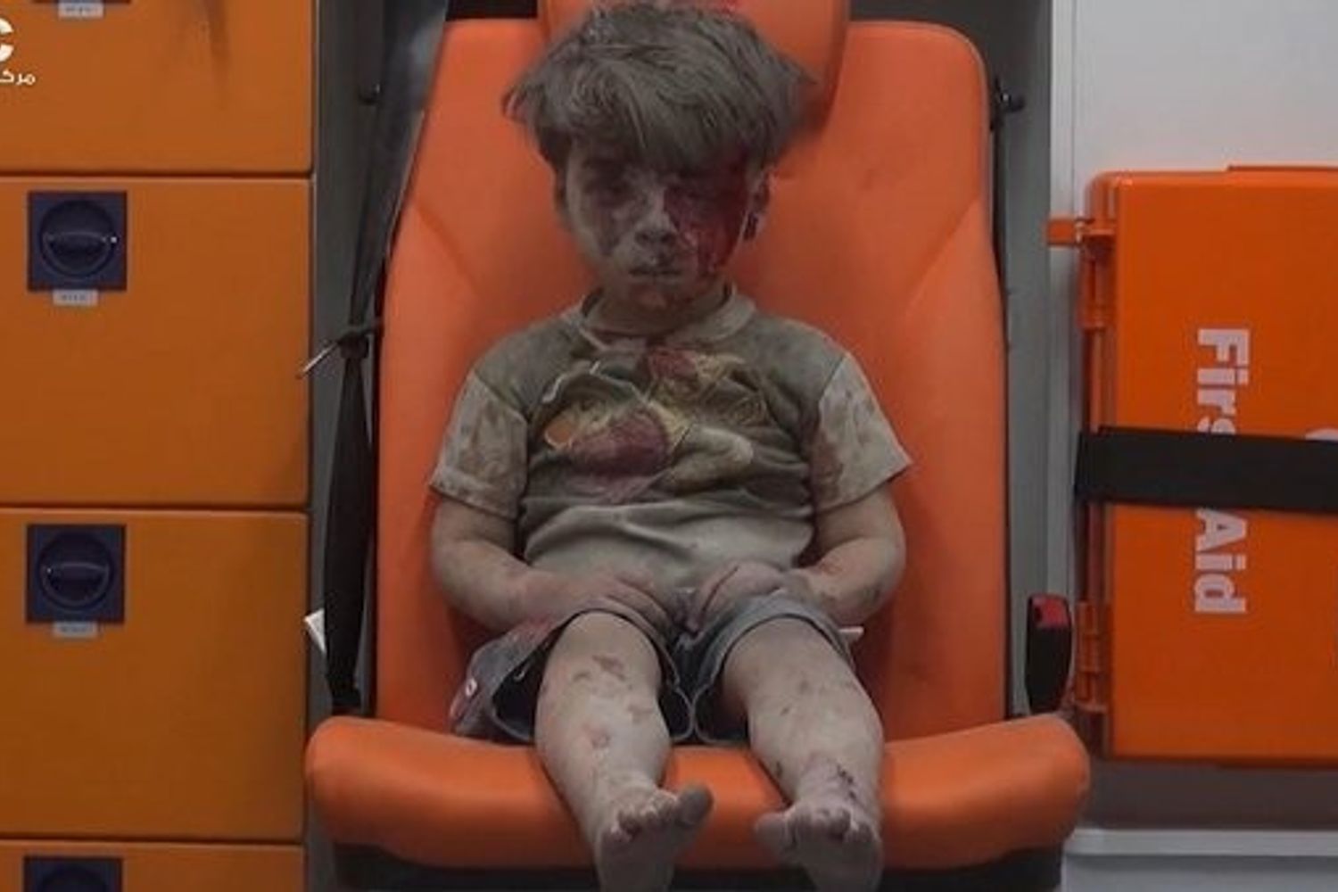 Omran Daqneesh (foto da twitter)&nbsp;