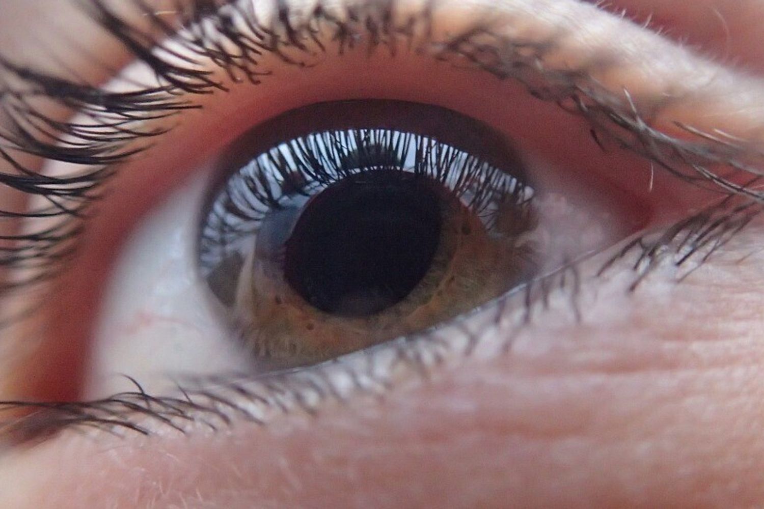&nbsp;occhio cornea