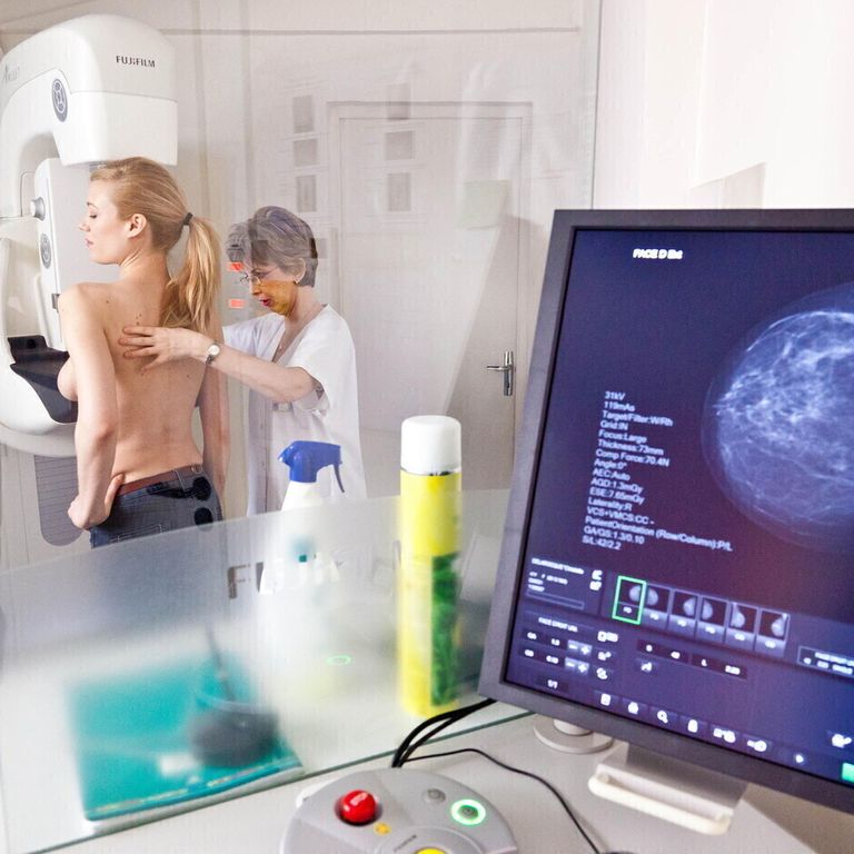 Tumore al seno - mammografia digitale (Agf)
