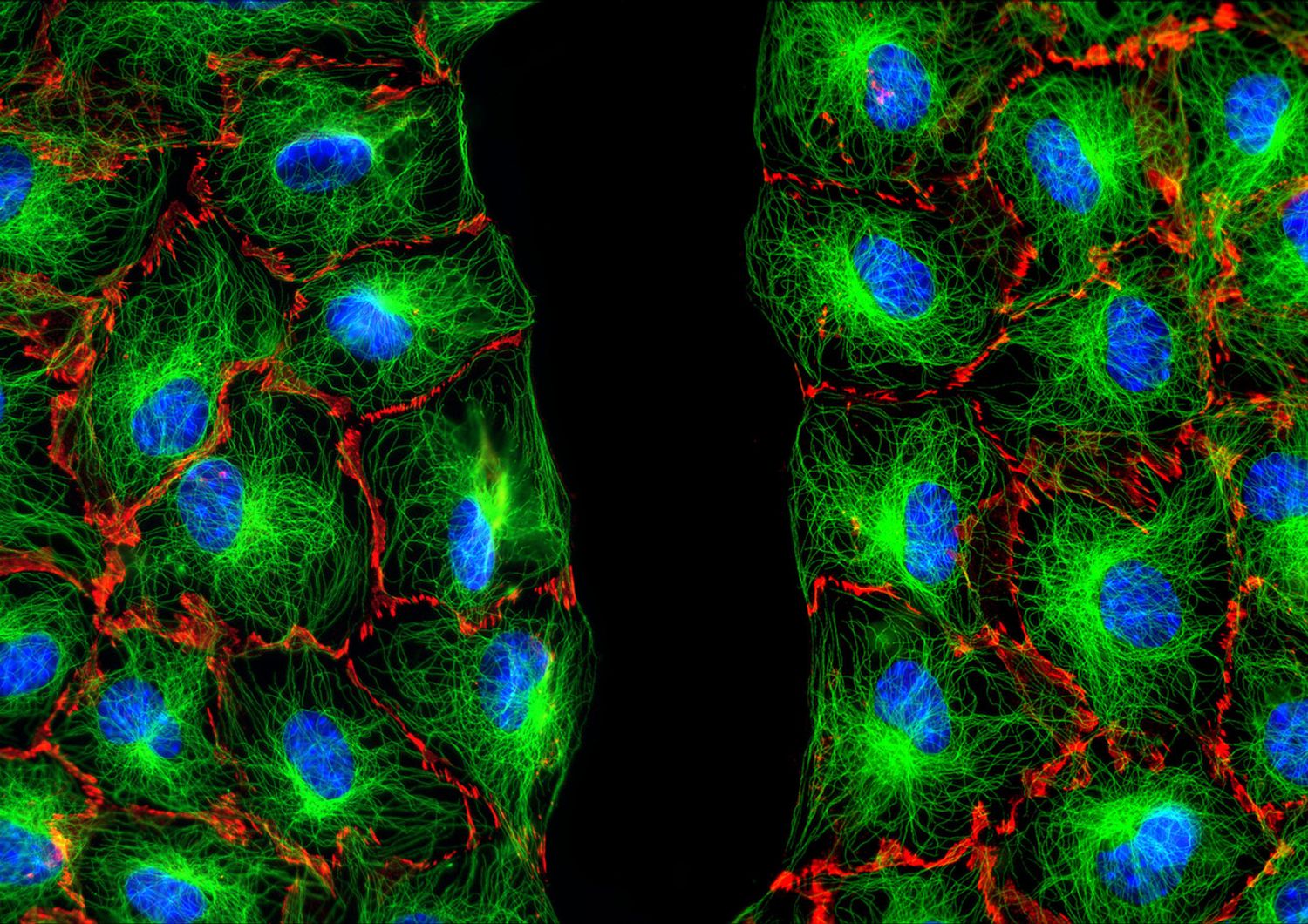 tumori - cellule fibroblasti (Agf)