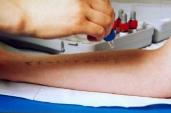 intolleranze alimentari allergie prove allergiche