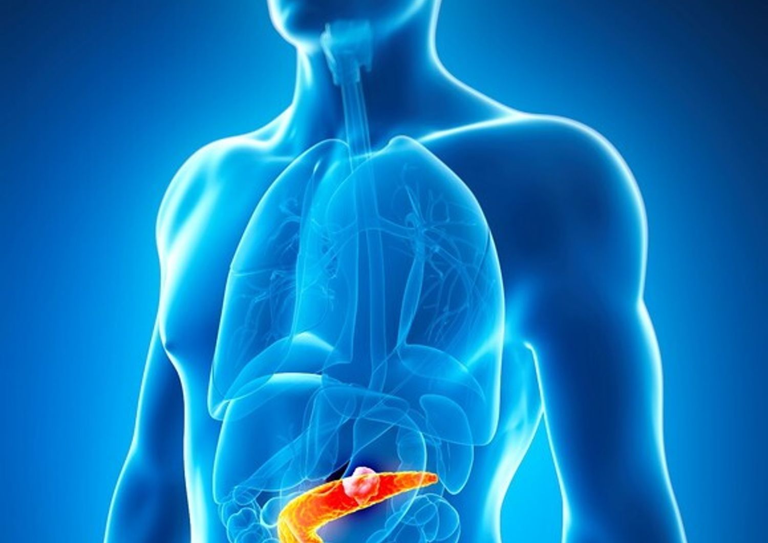 cancro tumore pancreas (afp)