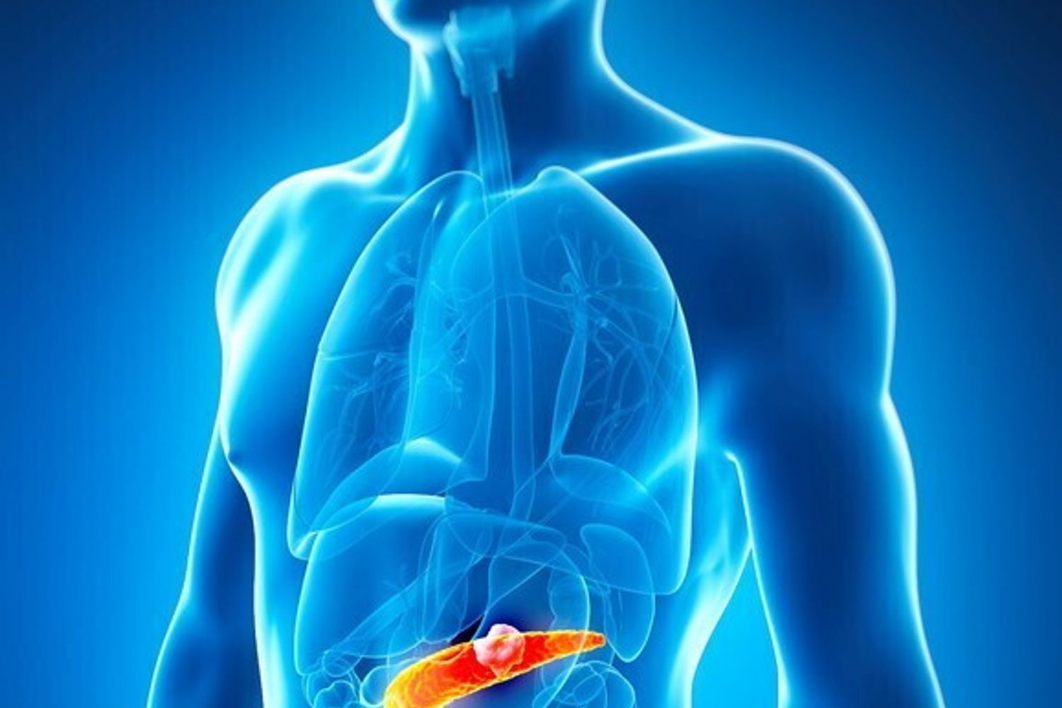 &nbsp;cancro tumore pancreas (afp)