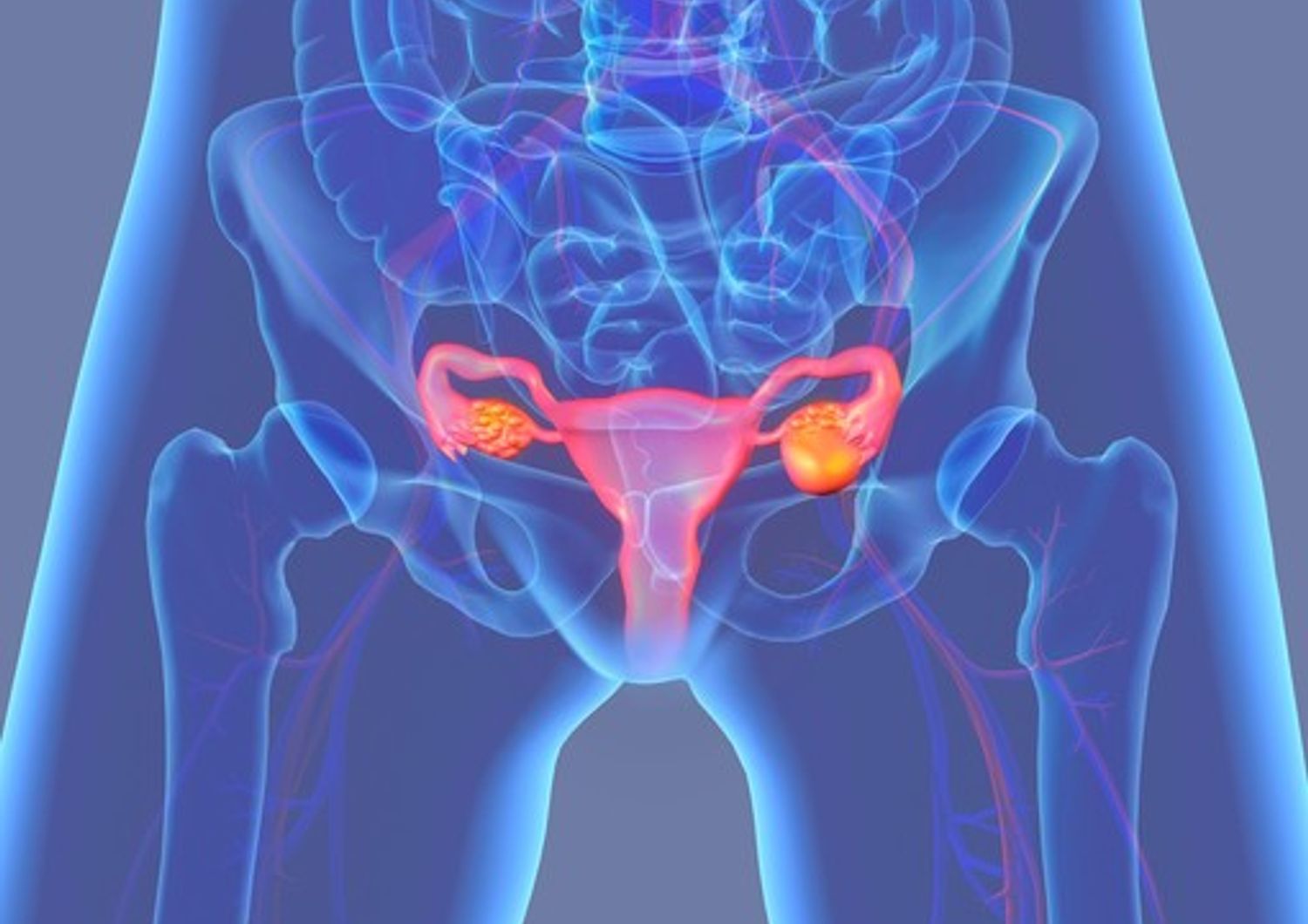 &nbsp;utero ovaie ovaio tumore cancro (afp)