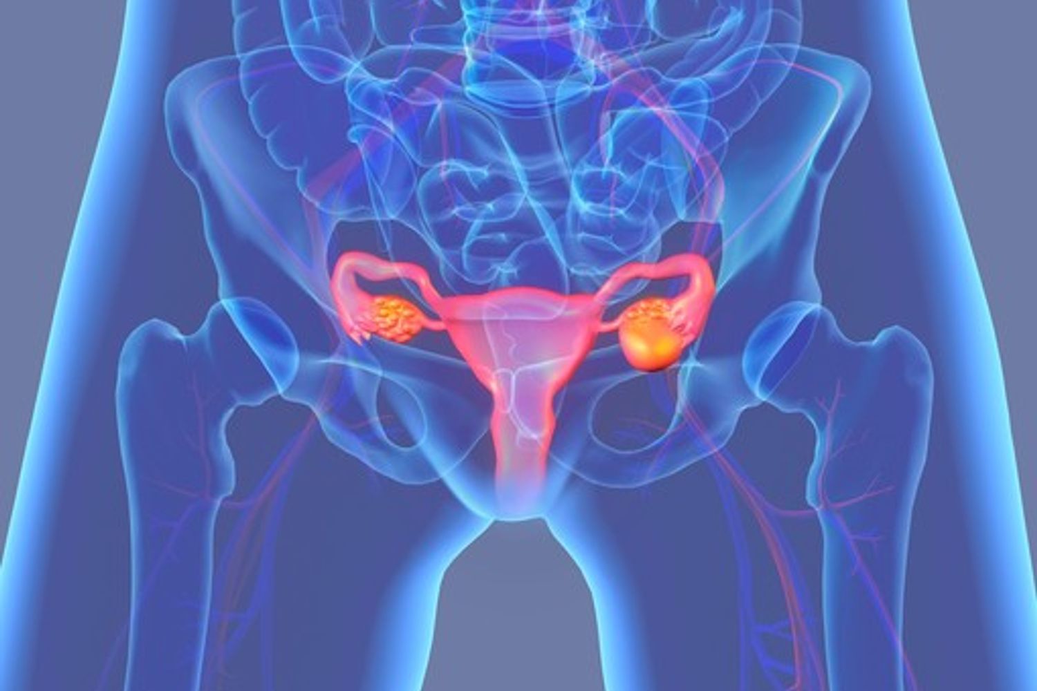 &nbsp;utero ovaie ovaio tumore cancro (afp)