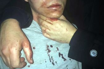 &nbsp; Polizia turca arresta e interroga Andulkadir Masharipov &nbsp;il jhadista indagato per il massacro di Capodanno (Afp)