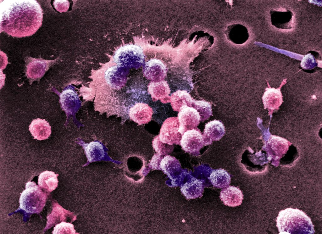 Linfociti (Afp)&nbsp;