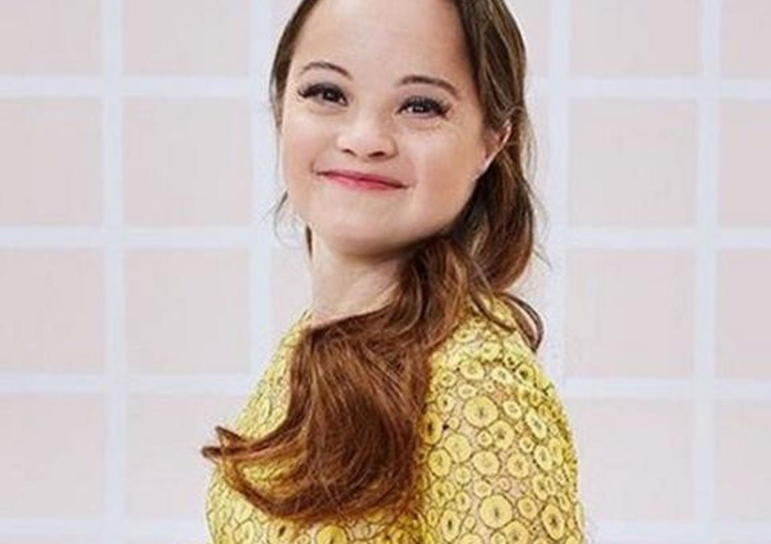 Chi è Katie Meade, la prima modella con la sindrome di Down