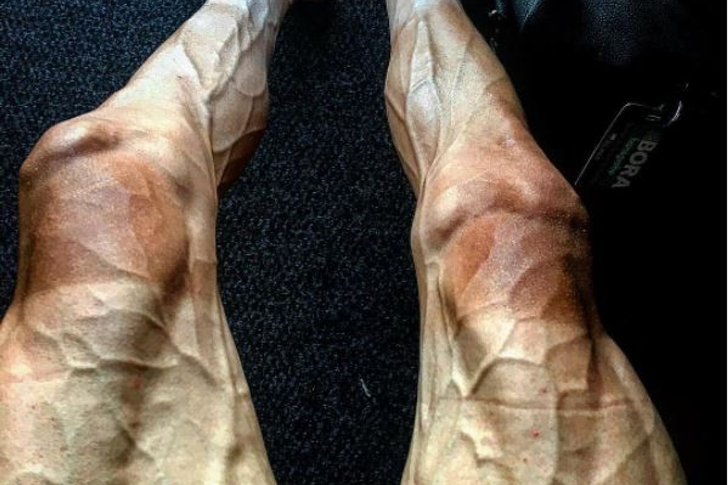 &nbsp;Polijanski, la foto dell'atleta polacco