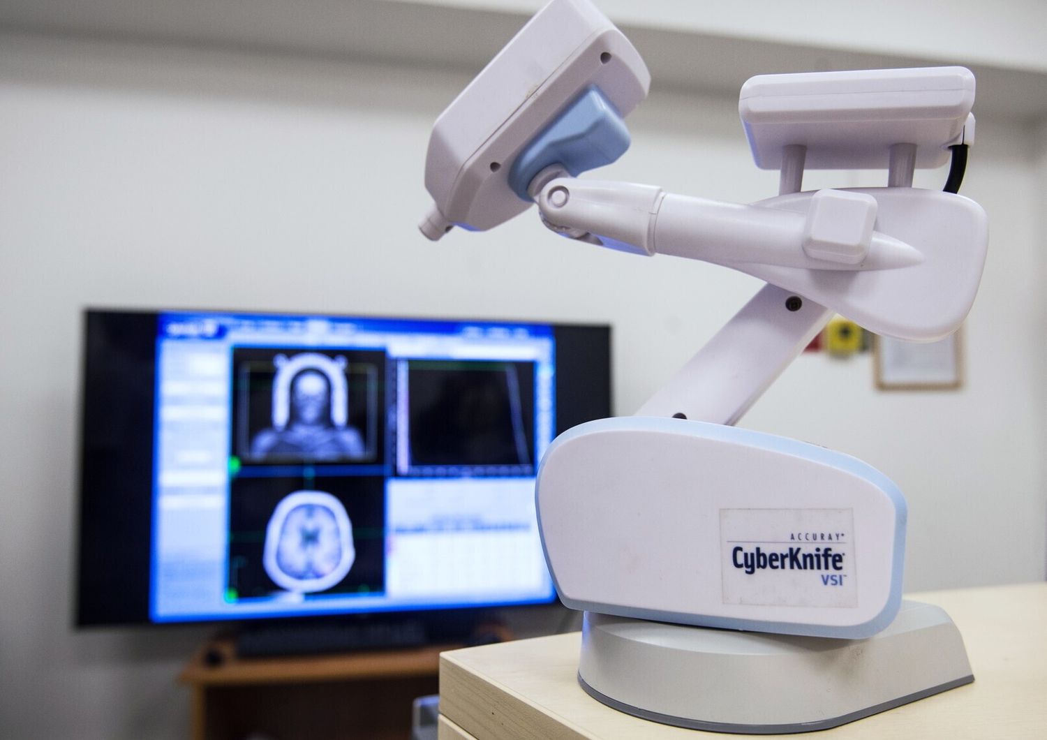 cyberknife radioterapia tumori