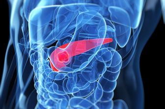 &nbsp;tumore al pancreas
