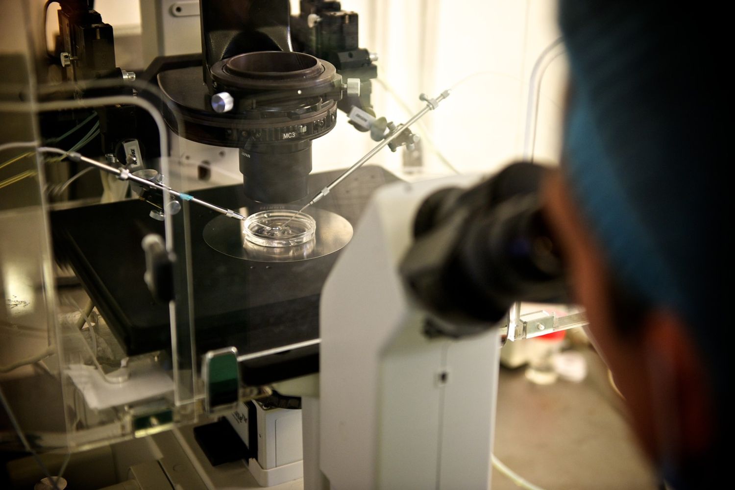 &nbsp;Biopsia, analisi dei tumori