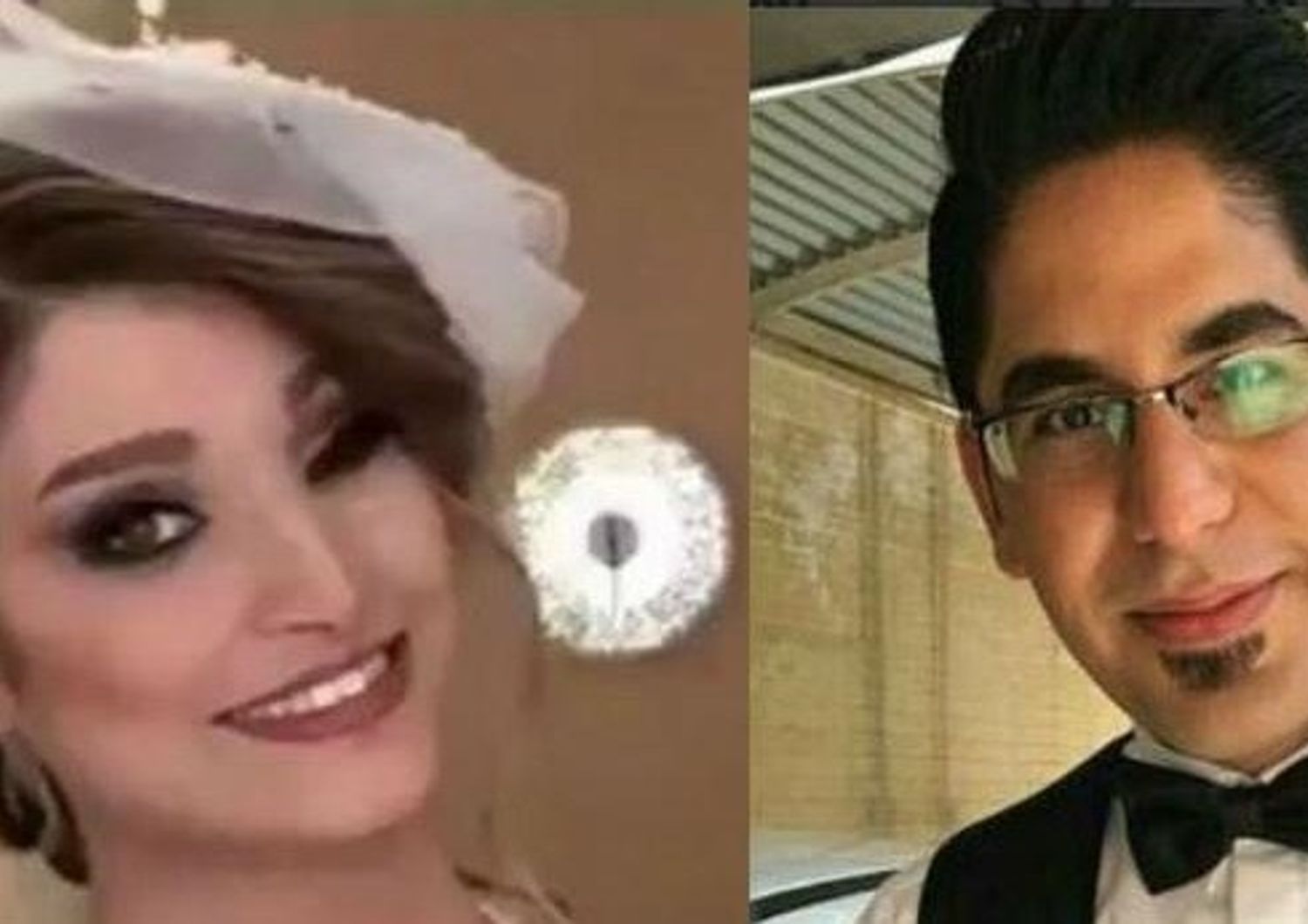 Marziyeh, la ragazza sfregiata con l'acido in Iran si sposa