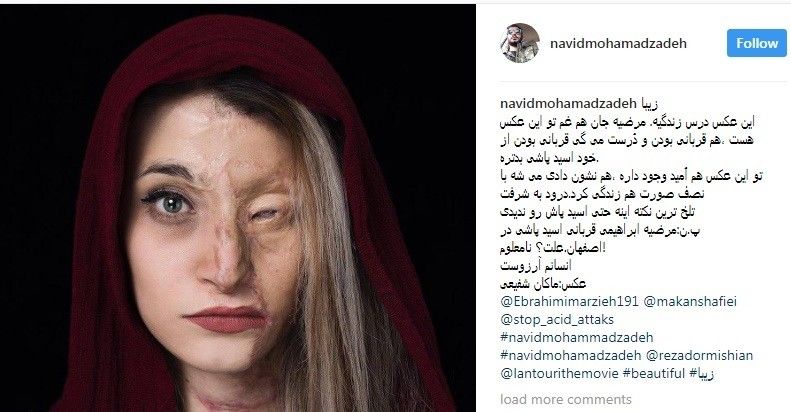 Marziyeh, la ragazza sfregiata con l'acido in Iran si sposa