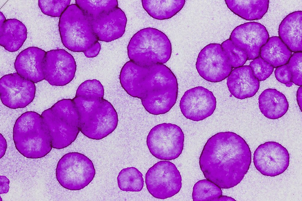 &nbsp;Colonie generate da un oloclone 1