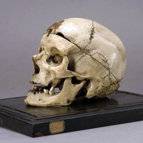 Cranio Brigante Villella&nbsp;