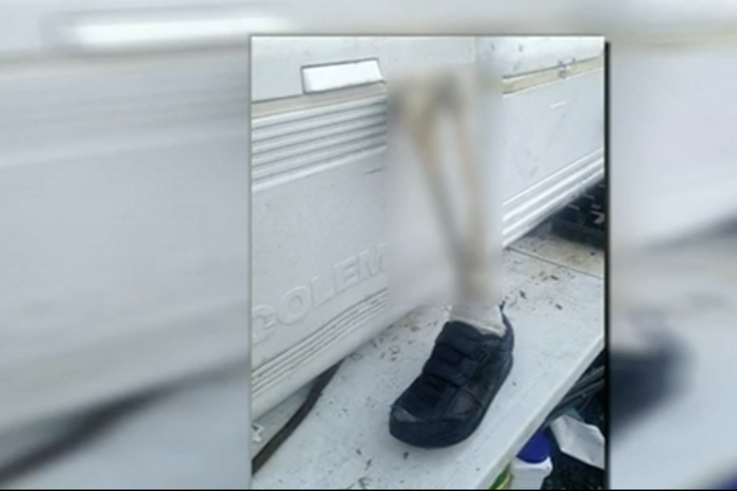 piede umano columbia&nbsp;