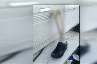 piede umano columbia&nbsp;