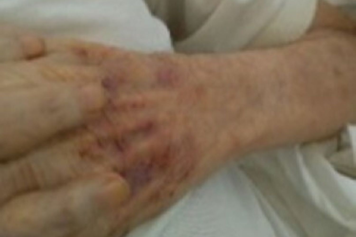 anziani maltrattati&nbsp;