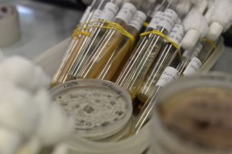 &nbsp; Agroterrorismo, epidemie agricole